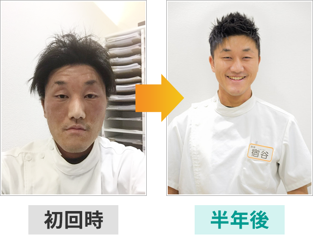 ビフォーアフター