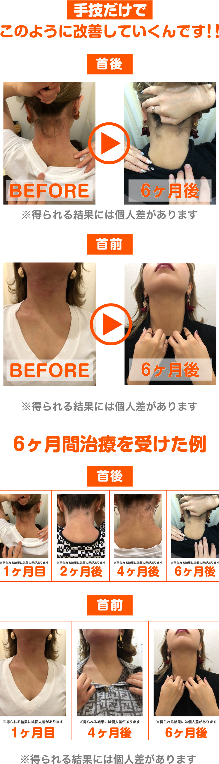 ビフォーアフター