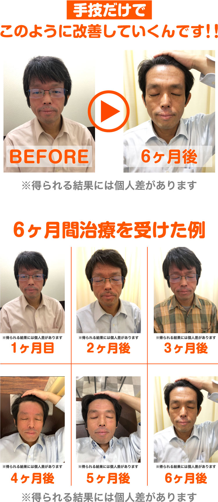 ビフォーアフター
