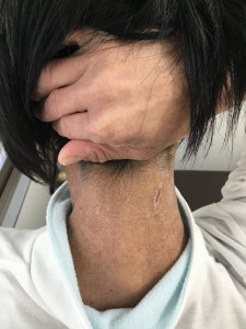 初回