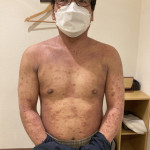 初回の写真